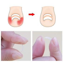 Ingrown Toenail Pedicure Tool 10pcs/bottle Straightening Clip Curved BS Brace Toenails Thick Paronychia Correction Tool Foot