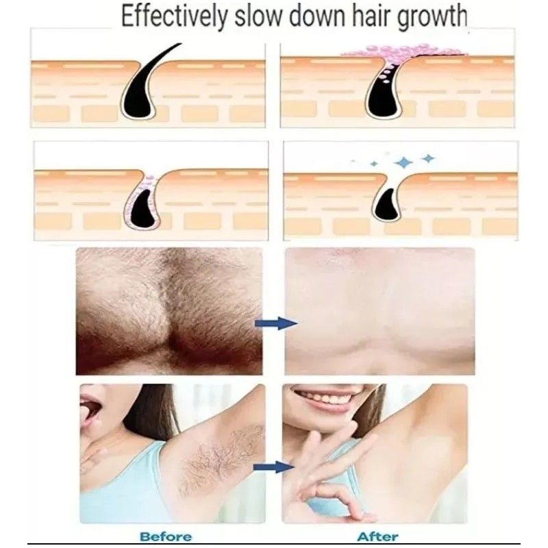 CODA EPIL Depilador Y Exfoliante Manual Borrador Magico Unisex