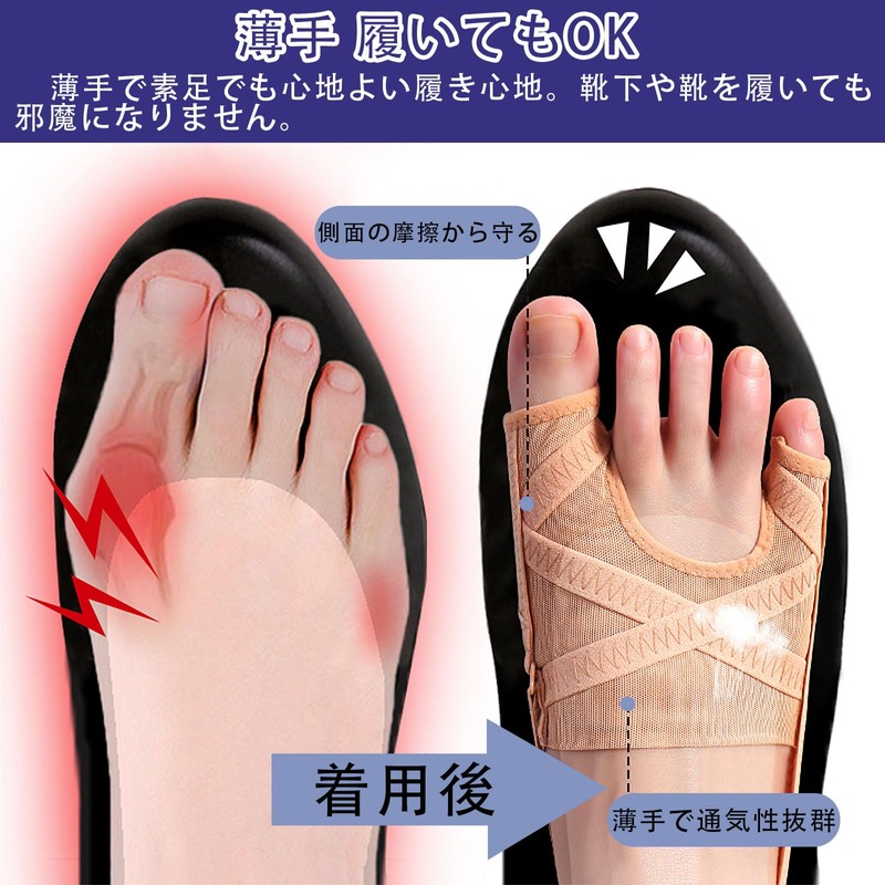 FINGOOO Bunion Supporter, Metatarsal Toes, Correction, Toe Supporter, Adjustable, Thin,