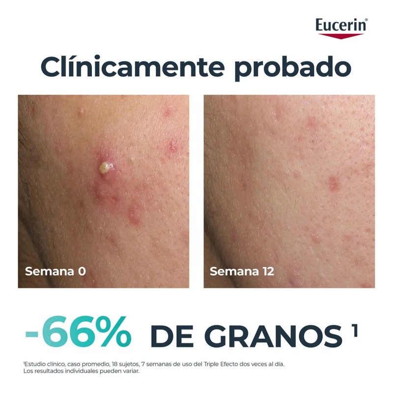 Eucerin DermoPure Gel de Limpieza Facial 400 ml | Control