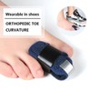 Toe Straightener, Toe Straightening, Toe Splint 1 Pair Toe Straightener