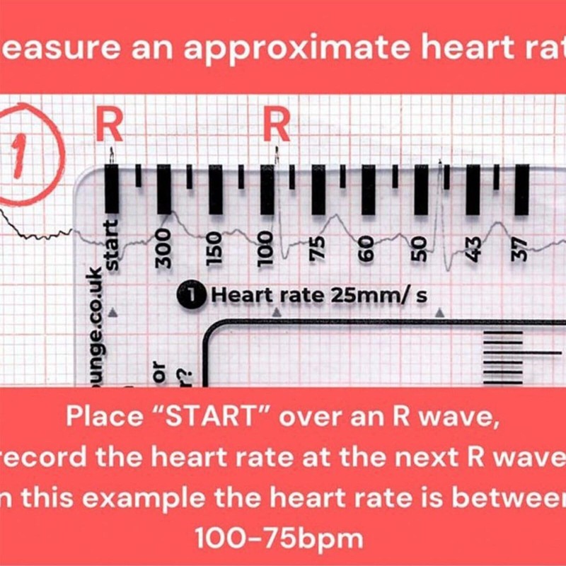 ECG RULER Pocketcard - Transparent EKG Calipers 7 Step Ruler