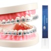 B Rush Comfort Cover for Braces -Orthodontic Lip Bumper, Lip