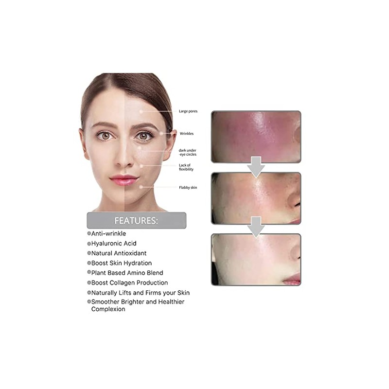 Eelhoe Eternity Vitamin C Serum Dark Spot Corrector, Esencia de