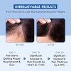 Botanic Hearth 100% Pure Rosemary Oil for Hair Growth Infused