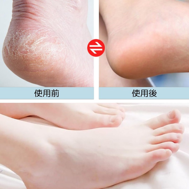 Heel Exfoliating Exfoliating Remover, Heel Care, Double-Sided File