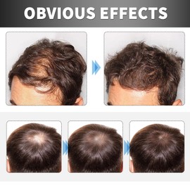 2 Pcs Anti Grey Bar Anti Grey Bar Men Lorenge Anti-Grey Bar Anti Grey Bar Lorenge Anti Grey Bar Anti Grey Bar Anti Grey Bar Men Lorenge Anti-Grey Bar Lorenge Bar Anti Grey Bar Lorenge