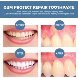 5PCS Gum Repair Gel Treatment,Gum Shield Gel,Teeth Repair ge/l,Oral Care for Teeth Pen,Teeth Whitening Essence Pen,Revitalizes G/ums for Tee/th,Instant Tee/th Treatment Essence Pe/n
