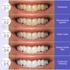Teeth Whitening Strips Bleaching Teeth, Whitening Teeth Strips, Effective and