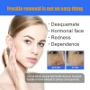 Crema Aclaradora Facial Moteada 50 G, Melasma Speckle Moistu