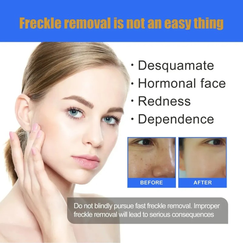 Crema Aclaradora Facial Moteada 50 G, Melasma Speckle Moistu