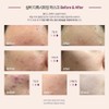 Leviderm Silver Detoxifying Mask 50ml Silver Pack / 레비덤 실버