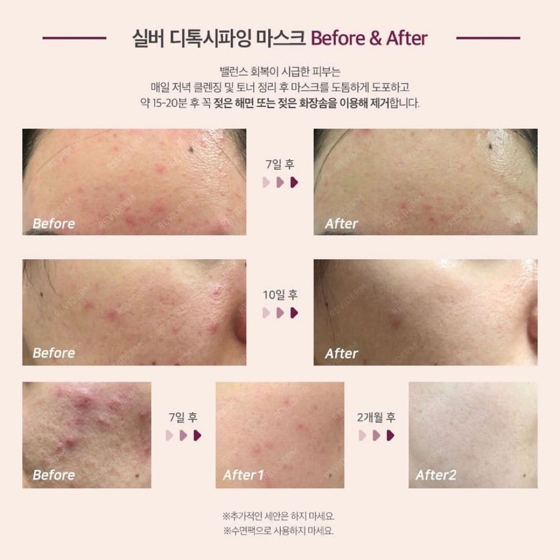 Leviderm Silver Detoxifying Mask 50ml Silver Pack / 레비덤 실버
