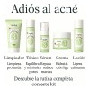 Kit Skincare Antiacné Vogirlog 5 Pasos Control Grasa