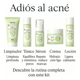 Kit Skincare Antiacné Vogirlog 5 Pasos Control Grasa