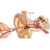 Remos ear cleaner for hygienic removal of earwax