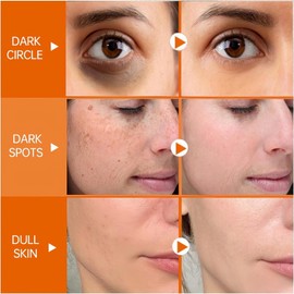 Vitamin C Face Cream With Niacinamid and Retinol,Anti Aging Wrinkles,Brightening Face Moisturiser for Dark Spots Acne,Retinol Night Cream,Day Cream for Women Anti Aging,Wrinkle Fillers,Night Serum