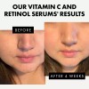 Eclat Suero Retinol Para Ojos Y Suero Facial De Vitamina