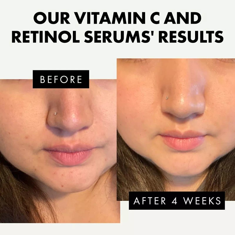 Eclat Suero Retinol Para Ojos Y Suero Facial De Vitamina
