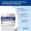 TAGRID Folliculitis