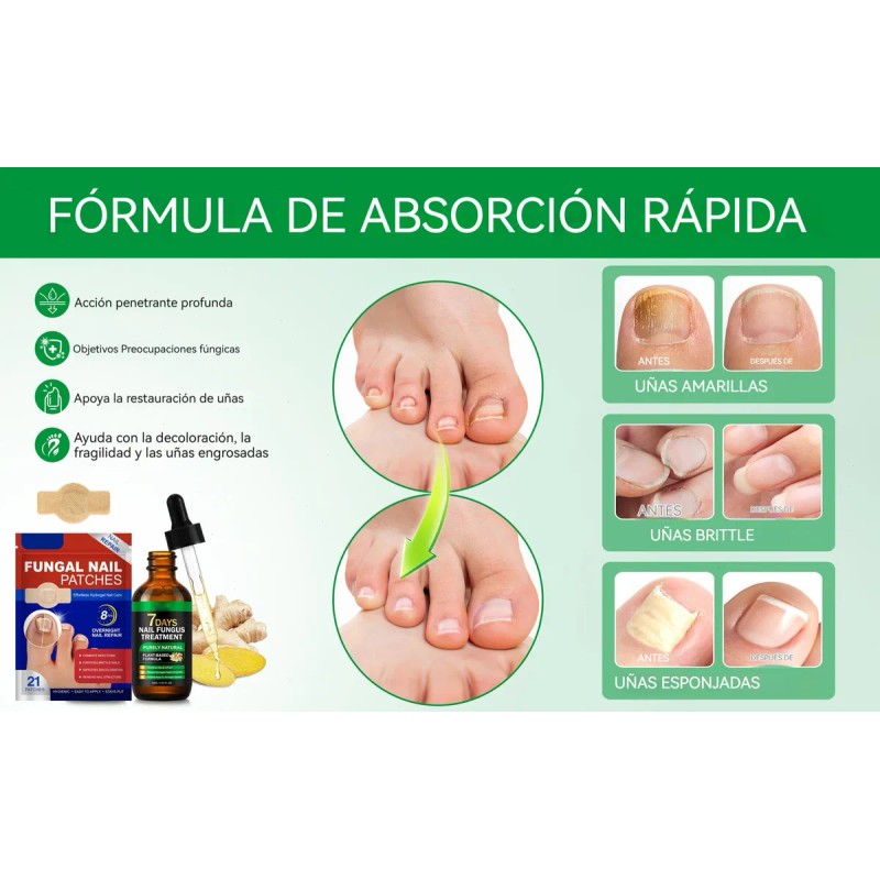 Parches Antimicóticos For El Tratamiento De Uñas