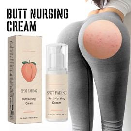 KOAHDE Natürliche Akne-Behandlungscreme für Po und Oberschenkel,Dunkle Flecken auf dem Gesäß,Gesäß-Pickel-Creme,Po-Akne Clearing Spot-Behandlung Cream,Butt Pickel Clearing Behandlung Treatment,100ML