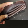 ATOPNIER 3pcs Scalp Comb for Dandruff,Hollow Tooth Lice Comb,Scalp Comb