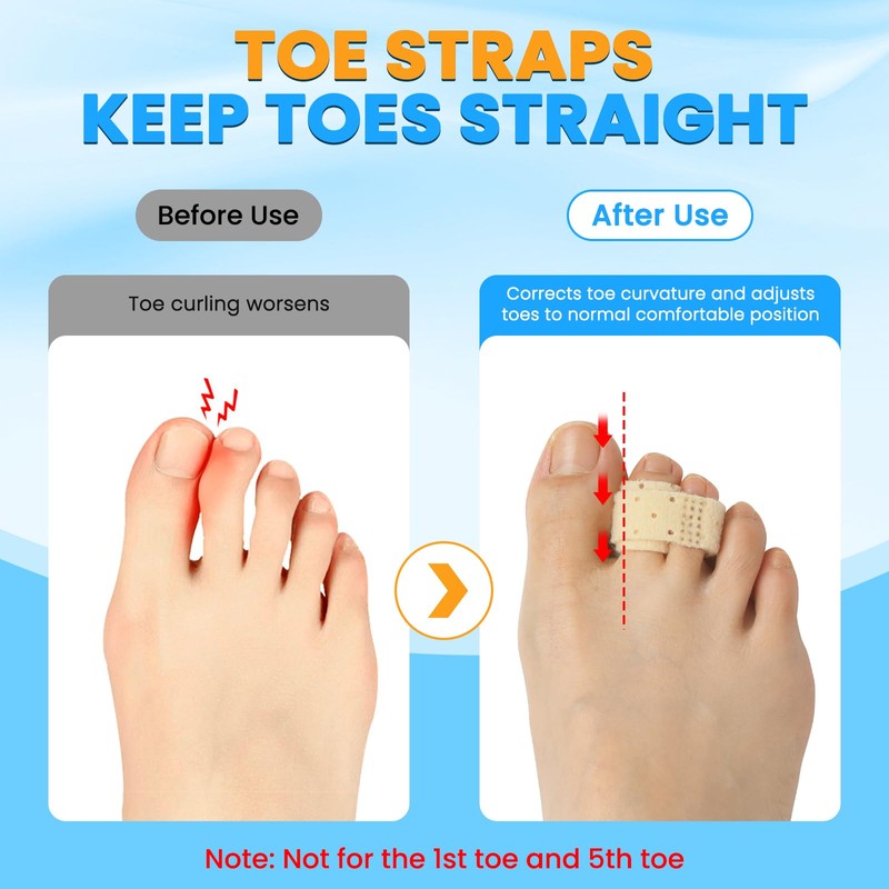 TASZOOS Hammer Toe Corrector for Women & Men - 6