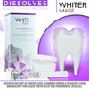 Whiter Image Deluxe Teeth Whitening Kit to Eliminate Teeth Discoloration