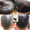 Suero Tratamiento De Las Canas, Unisex, Color Natural