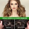 Aliver - Batana Oil - 60 Ml - Cuidado Cabello