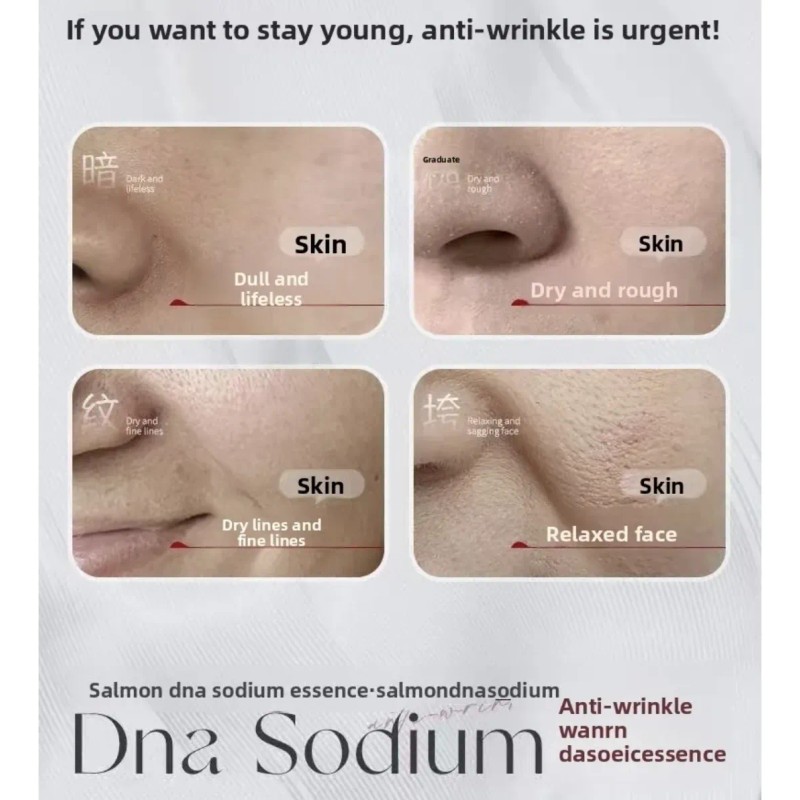 Pdrn De Salmón Suero Dermapen 10 Unidades Todo Tipo De