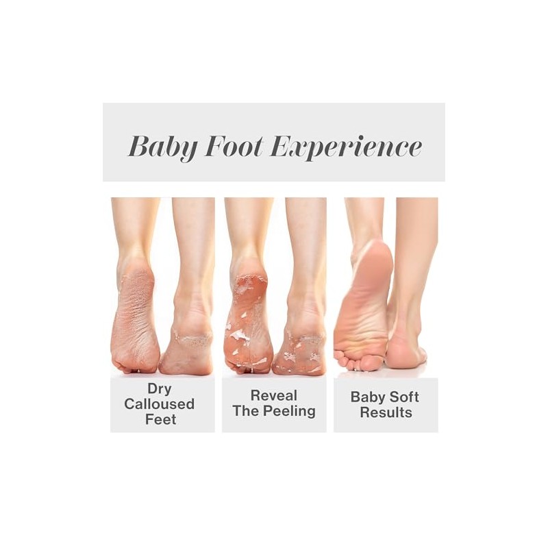 Baby Foot Exfoliation Foot Peel, Exfoliación Para Los Pies, Lavanda