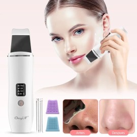 Limpiador Facial Ultrasónico Limpieza Eliminación Espinillas