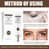 Anti-Ageing Eye Cream Anti-Wrinkle Eye Cream Eye Care Against Wrinkles
