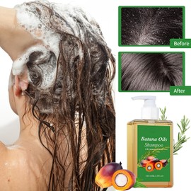 Batana Oil Shampoo,Batana öL FüR Haare Shampoo,Vital Strands Batana Oil,Haar NäHren, Haar Weich Machen, Haarpflegeprodukte FüR Dickes Haar (100ml) 1 St. Kamm
