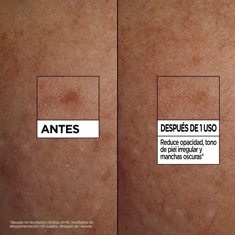 Kit Iluminador Express Aclara Garnier Vitamina C 3pasos Seco
