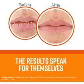 O'Keeffe's Unscented Lip Repair Lip Balm for Dry, Cracked Lips, Stick, (Pack of 3)