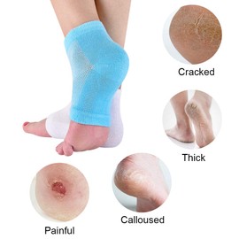 Moisturizing Socks, Gel Heel Socks, Toe Open Socks, Relieve Heel Pain Comfortable Soft Vented Moisturizing Socks Suitable for Male and Female Day Night Care Skin Dry Cracked High Heel, 2 Pairs