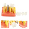Gatuida 1pc Tooth Model Learher Gronwn Ups Teeth Teaching Model