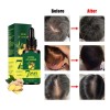 Sérum Para El Crecimiento Del Cabello, 1 Dosis De Aceite