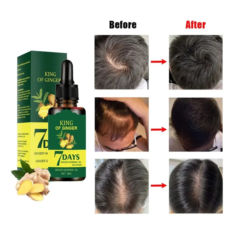 Sérum Para El Crecimiento Del Cabello, 1 Dosis De Aceite