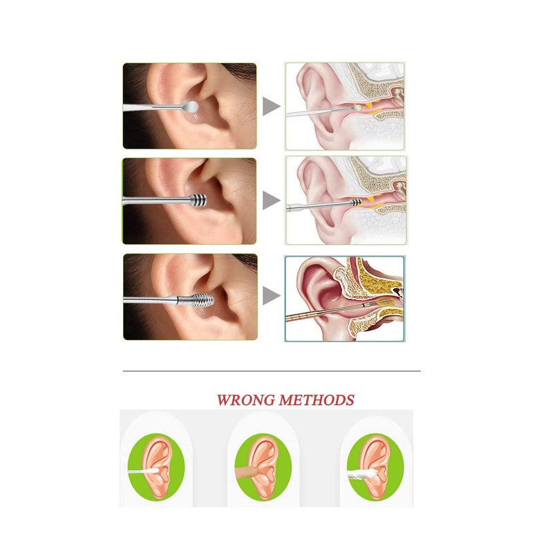 8 Pcs Ear Pick Earwax Removal Kit, Ear Cleaning Tool