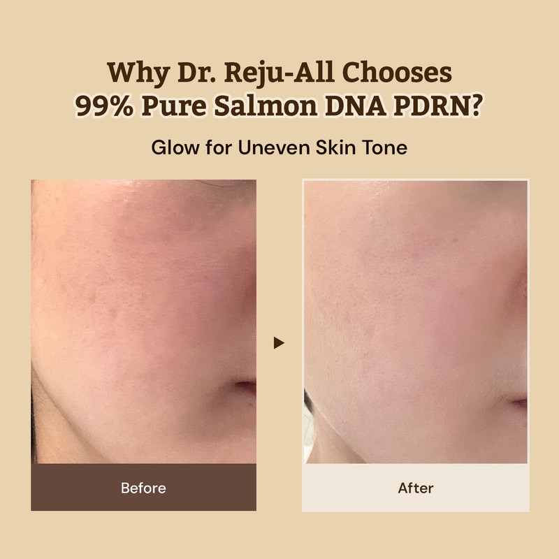 Dr.Reju-All [Dr.Reju-All]*renewal* Advanced PDRN Rejuvenating Cream 60ml