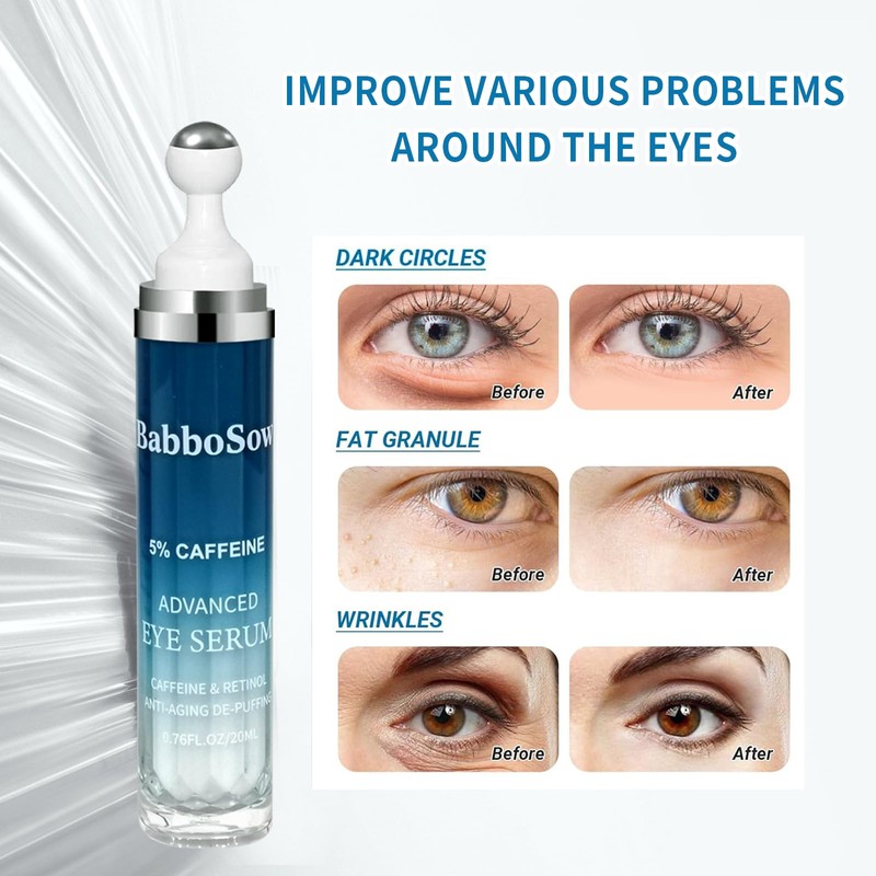 Under Eye Cream for Dark Circles with 5% Caffeine and