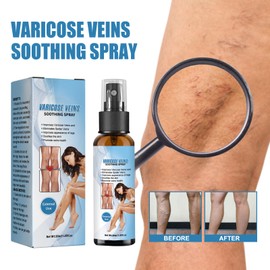 Beinpflegespray, gegen Krampfadern, beruhigendes Behandlungsspray, beruhigende Creme für die Beine, verbessert die Durchblutung und lindert Schwellungen, Flüssigkeit für Krampfadern