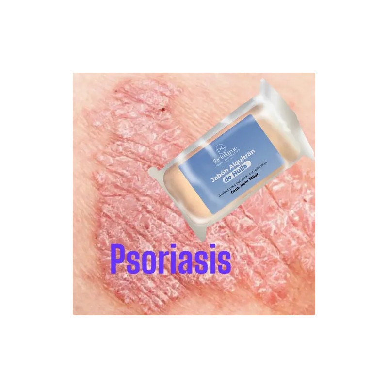 Psoriasis Kit 6 Productos 2 Urea 2 Crema 2 Jabones