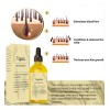 Aceite Para El Crecimiento Del Cabello Kisinly Veganic Rosem