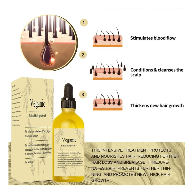 Aceite Para El Crecimiento Del Cabello Kisinly Veganic Rosem