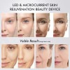 2025 Age Beauty Device Booster Skincare Pro Home